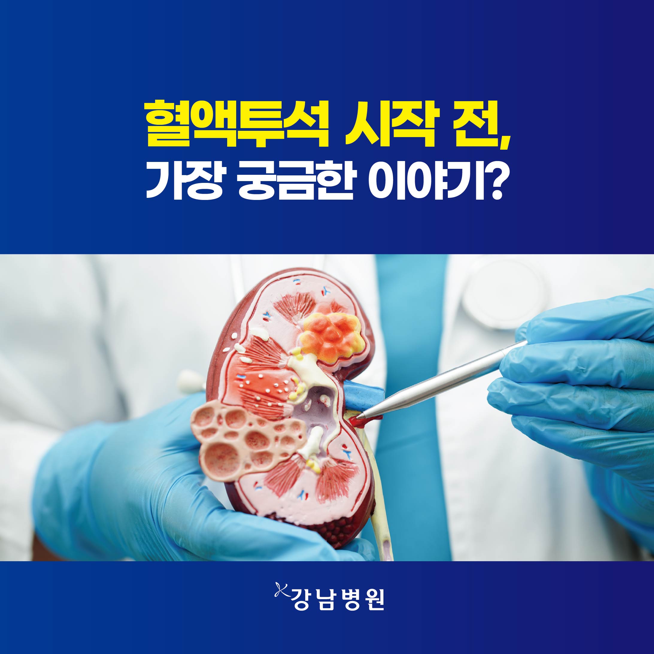 혈액투석 시작 전 가장 많이 궁금해하는 이야기sns_260803-01
